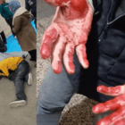 Exclusive Interview: Physician Treating Protesters in Iran Describes Mass Casualties, Overwhelmed Hospitals