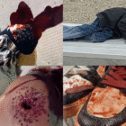 Unreported Atrocities: Eyewitnesses Detail Massive and Deadly State Crackdown Against Protesters in Iran’s Provincial Cities