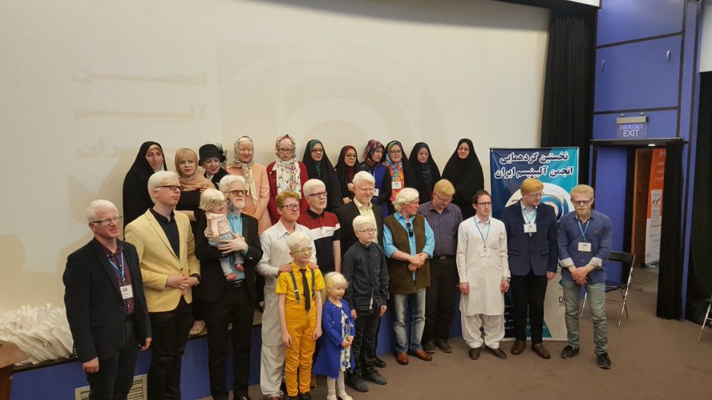 In April 2018, Iran’s first organization dedicated to promoting the rights of people with albinism urged the Iranian government to seriously consider this vulnerable community’s needs and begin devising a plan to address them.